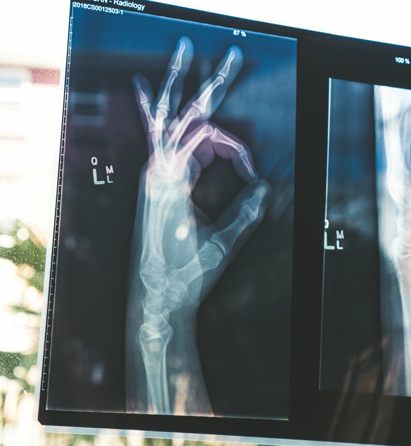 rƶntgen hand