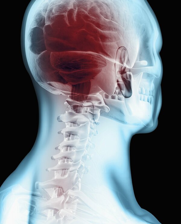 PG Neurologische zorg