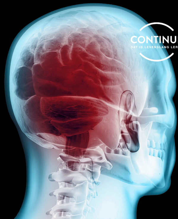 PG Neurologische zorg - Continue